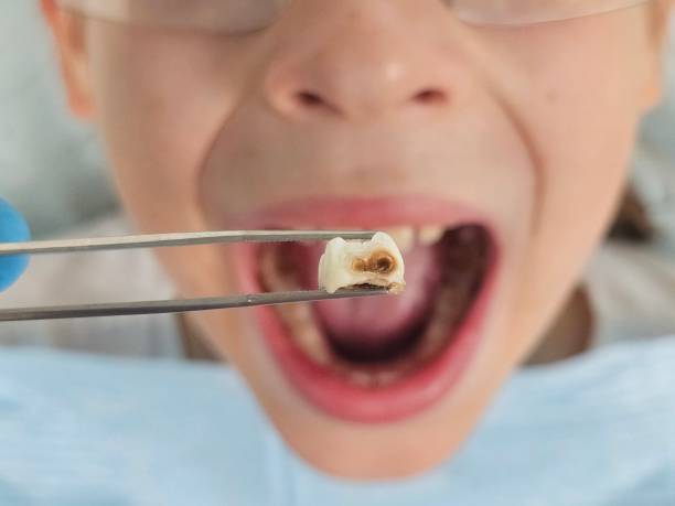 Best Tooth Infection Emergency Dentist  in Woodbine, GA